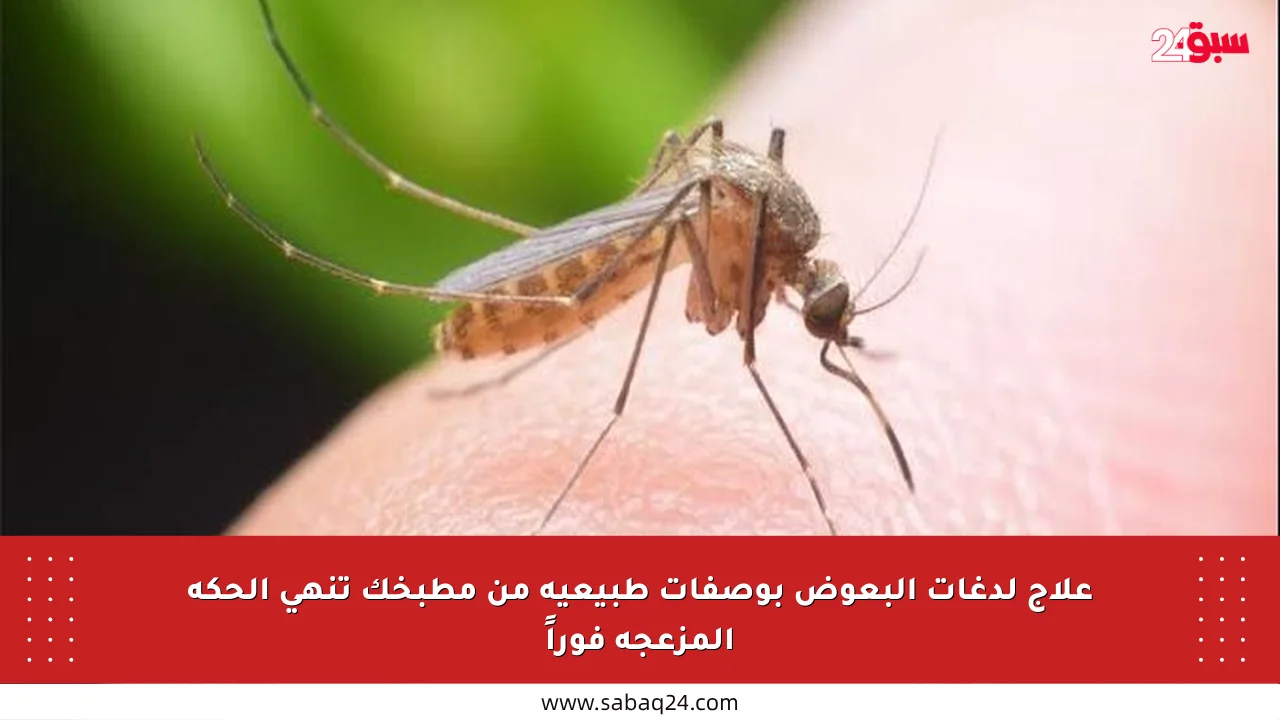 علاج لدغات البعوض بوصفات طبيعية من مطبخك تنهي الحكة المزعجة فوراً